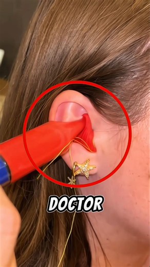 Why Doctors Put This in Your Ear 🤯