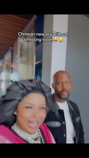 Chrisean Rock's New Smile: No More Missing Tooth