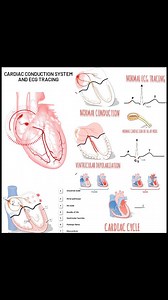 Cardiac Conduction System and ECG Tracing Discover the intricacies of the Cardiac Conduction System and its correlation with ECG tracings. This detailed animation illustrates the electrical impulses responsible for heart rhythm regulation, making it a valuable resource for cardiology learners and professionals. Enhance your understanding of cardiac electrophysiology and clinical practice through this visual aid. 📚🫀 Share your insights and experiences in the comments! @cardiobeatby_beat #Cardio