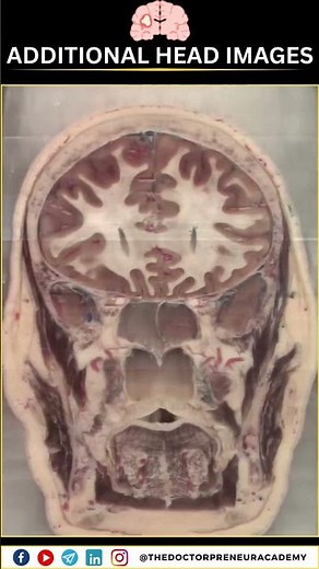 🔬 The Visible Human Project – Incredible 3D Head Imaging! 🧠