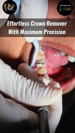 Hn Prolift Crown Remover Forcep a #crownremover Instrument #futureofdentistry #dentalequipment #yt