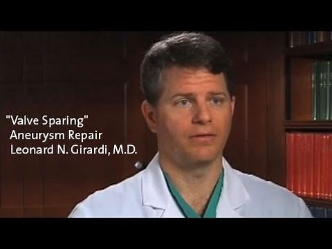 "Valve Sparing" Aneurysm Repair - Dr. Leonard Girardi