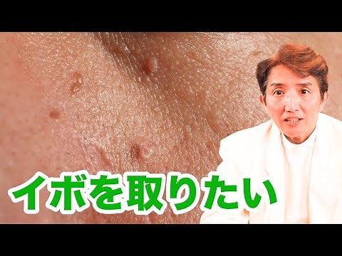 自宅でできる「首イボ」を取る方法について、肌再生の医師が解説