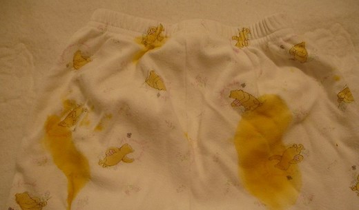 How To Get Poop Stains Out of Underwear? [4 Easy Ways]