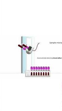 Auto Stainer (Slide Stainer) #technology #biomedicalengineerstv #pathology #pathologylaboratory
