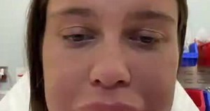 #OMG: Tiktoker undergoes treatment to dissolve lip filler, but suffers allergic reaction