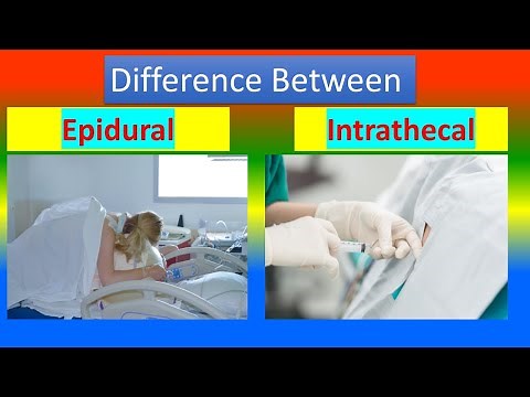 Difference between Epidural and Intrathecal