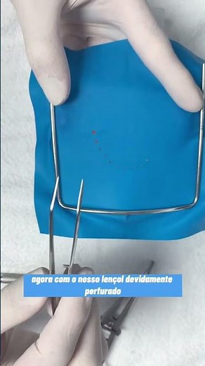 TÉCNICA PARA COLOCAR O LENÇOL DE BORRACHA EM BOCA - ODONTO UFRGS