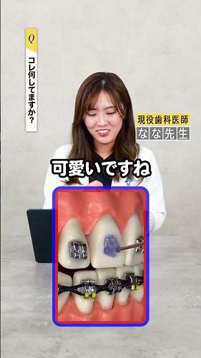 ブラケットの付け方を解説！ #女医 #歯科医師 #歯科 #歯医者 #歯