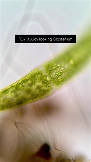 I can’t stop staring at algae. Sample: Pond water, Closterium sp. 🔬 Motic BA310 #biology #algae #microscope #stem #closterium