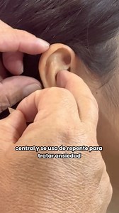 🎯 ¿Sabías que tus oídos pueden ayudarte a mejorar tu salud?La acupuntura auricular es una técnica milenaria que estimula puntos específicos en la oreja para aliviar dolores, ansiedad, insomnio y más. | Hola El Salvador