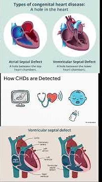 Congenital Heart Diseases | Types, Causes & Anatomy Explained | Pediatric Cardiology Simplified” 2