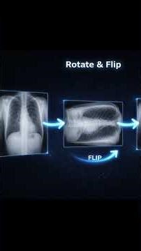 End to End Deep Learning project (Pneumonia detection ai) 🔥 #deeplearning #machinelearning #coding