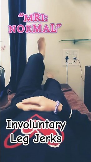 “Young Patient With Sudden Involuntary Leg Jerks | Myoclonus?”