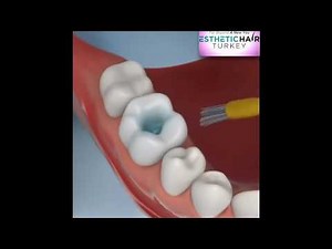 Common Dental Procedures