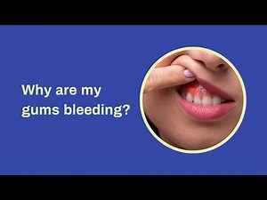 Why Do My Gums Bleed After Using autobrush?