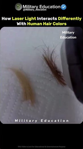 Why Dark Hair Burns Faster During Laser Treatment – The Science Explained