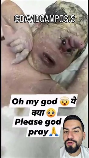 CYCLOPS BABY #cyclopia