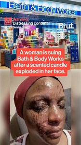 29K views · 95 reactions | A woman is suing Bath & Body works and Premier Candle Corporation after a "Sweater Weather" scented candle exploded in her face, causing severe burns. ⁣ | Brut India | Facebook