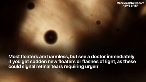 Dark Spots Floating in Your Eyes: When to Worry and When to Relax