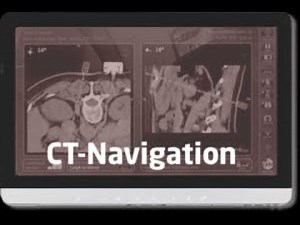 Imactis CT-Navigation System