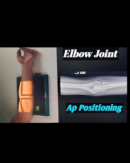 #Elbow Joint (AP Positioning)#shortvideo