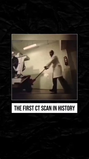 Radiology Hub on Instagram: "The first human CT scan was performed on October 1, 1971, at Atkinson Morley's Hospital in London by radiologist James Ambrose, using technology developed by engineer Godfrey Hounsfield (who later won a Nobel Prize for it). This groundbreaking scan revealed a brain tumor in a 41-year-old female patient, ushering in a new era of detailed internal imaging for the entire body, though early scans were slow and grainy, requiring mainframe computers for processing. Key Det