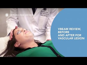Vbeam Review. Before and After for Vascular Lesion -- Victoria Park