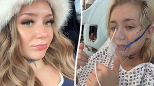 Vaping woman, 21, has part of lung removed after getting cancer