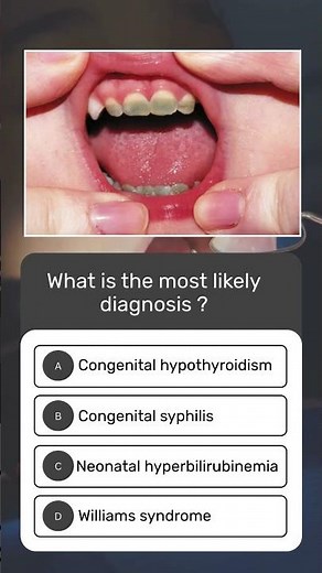 Can You Crack This Diagnosis? 🧠🔥 | Quick Clinical Quiz Challenge