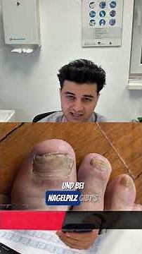 Nagelpilz? So therapiert man richtig #nagelpilz #nagel #kaputt