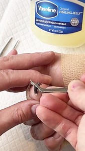 3.7M views · 11K reactions | Wow he got it out so quickly  . . Videos on this page include scripted dramas, satires, parodies, and other forms of entertainment. Names, characters and incidents are often the product of the director’s imagination, so any resemblance to actual persons or actual events is purely coincidental. The original video was produced by Rick Lax Productions, Network Media and Ricardo Laguna.. | Possibly Genius | Facebook