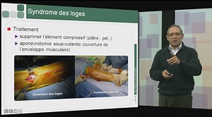 IFSI 2013 - Les processus traumatiques : 08 - Traumatologie de la jambe, de la cheville et du pied | Canal U