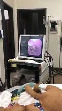 Endoscopy on a dog - Veterinary Video