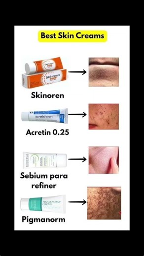 Best Skin Creams for Acne, Dark Spots & Open Pores | Skinoren, Acretin 0.025,