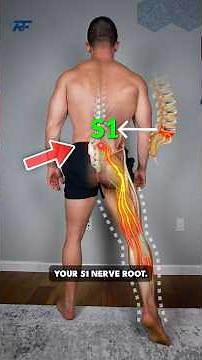 How to Know Which Nerve Is Causing Your Sciatica