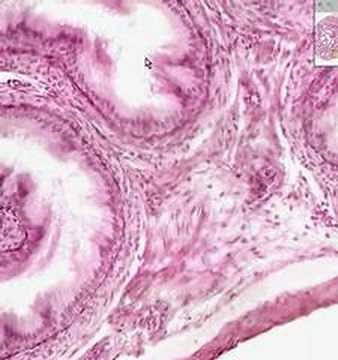 Shotgun Histology Epididymis