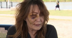Woman recounts altercation with Fort Worth officers, says she has bruises "everywhere"