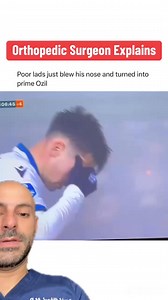 614K views · 2.6K reactions | Careful Blowing Your Nose with Broken Facial Bones!✅Follow @drdavidabbasi for More Daily Medical Content & Health Tips! Schedule a consultation to see Dr. Abbasi as a patient in Delray Beach! Visit www.primeorthocenter.com #soccer #sports #medicine #doctor | David Abbasi, MD - Sports Medicine & Orthopedic Surgery | Facebook
