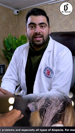 The #1 Hair Loss Doctor in Ghaziabad Shares 5 Effective Alopecia Totalis Solutions