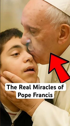 Did Pope Francis make miracles when he is alive? #pope #popefrancis #jesus #catholic ic