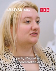 Nobody wants excess uncontrollable hair growth, especially if it's on your face. Will Dr. Emma be able to curb this condition and change this young lady's life forever? 📺 The Bad Skin Clinic - Mondays at 9:55PM (SEA) | 8:55PM (BKK/JKT) on TLC Southeast Asia | TLC Southeast Asia