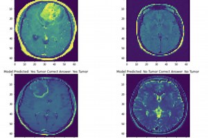 AI Disease Detection
