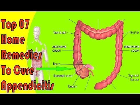 Top 07 Home Remedies To Cure Appendicitis