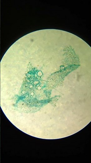 Xylem Tissue under Microscope