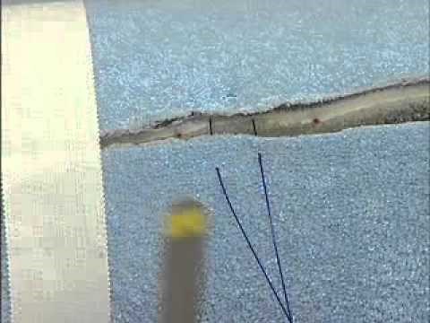 Interrupted Suture Patterns: Horizontal Mattress