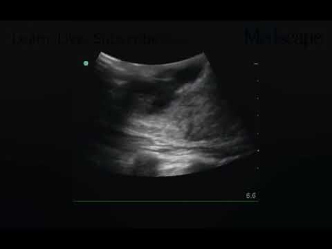 Breast Abscesses and Masses | Medical Review