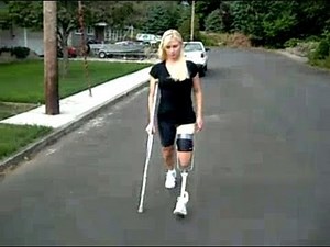 Transfemoral non-amputee prosthesis simulator (Chelsea)