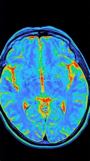 This Headache Gets Better When You Lie Down