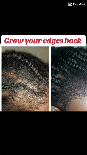 Edges Before & After 🌱 | Oil + Edge Control Results (Real Routine) #blackhairproducts #blackhaircare